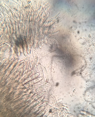 Coccomyces strobi