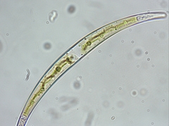 Closterium dianae