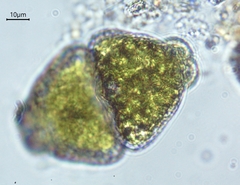 Euastrum ampullaceum