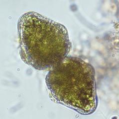 Euastrum ampullaceum