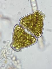 Euastrum ampullaceum