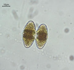 Staurastrum punctulatum