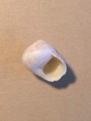 Chrysostoma paradoxum