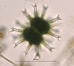 Staurastrum arctiscon