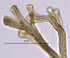 Spongomonas splendida