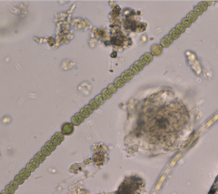 Dolichospermum