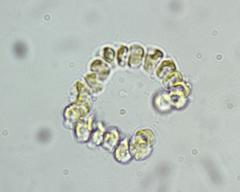 Cyclonexis annularis