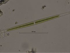 Closterium aciculare