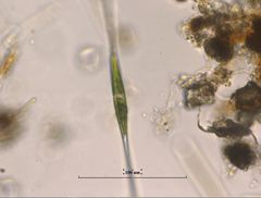 Closterium kuetzingii