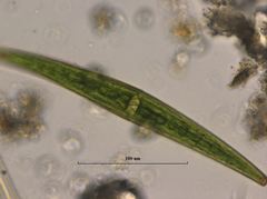 Closterium striolatum