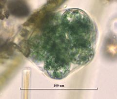 Glaucocystis