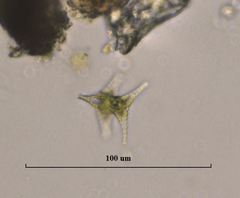 Staurastrum anatinum