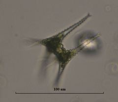 Staurastrum anatinum