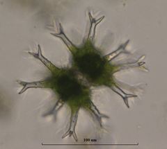 Staurastrum arctiscon