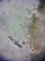 Stereocaulon dactylophyllum