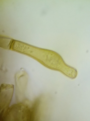 Botryobasidium simile