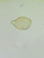 Botryobasidium simile