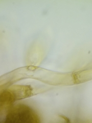 Botryobasidium simile