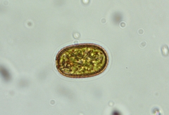 Trachelomonas abrupta