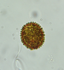 Trachelomonas robusta