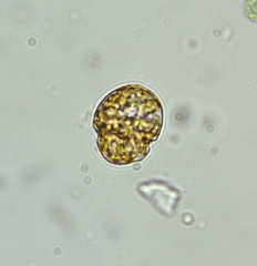 Parvodinium umbonatum