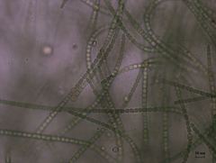 Dolichospermum