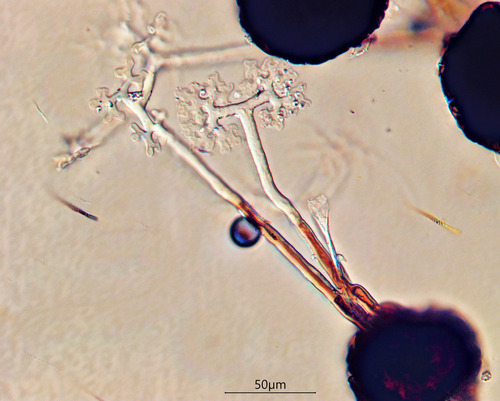 Podosphaera ampla
