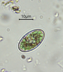 Glaucocystis