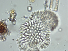 Anthophysa