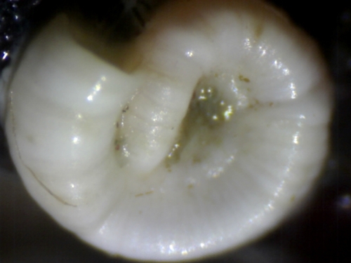 Spirorbis inornatus