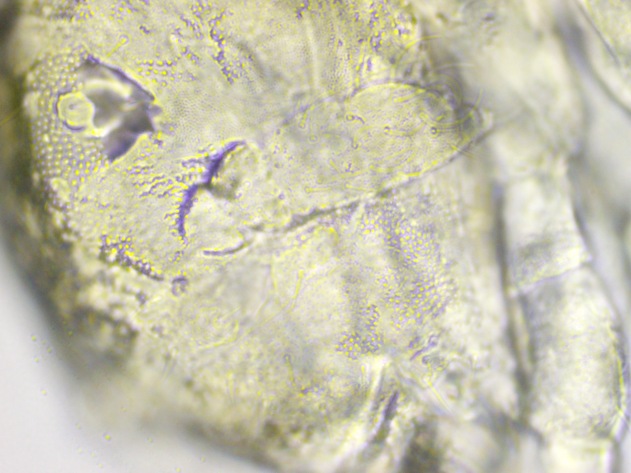 Megalothorax minimus V.Willem, 1900