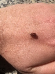 Gonioctena fornicata