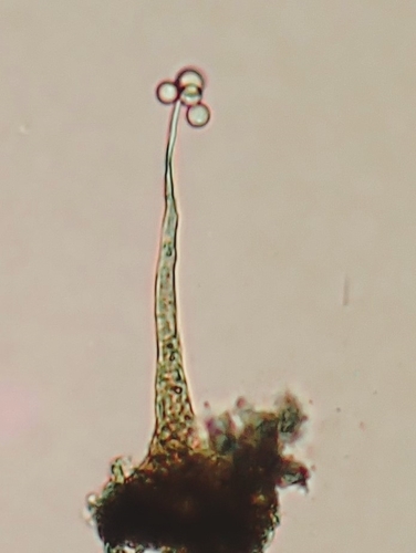 Representative image of Echinostelium apitectum