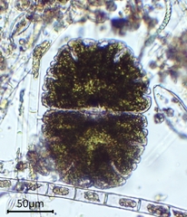 Micrasterias jenneri