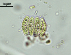Desmodesmus asymmetricus