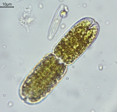 Tetmemorus brebissonii minor