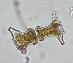 Staurastrum elongatum