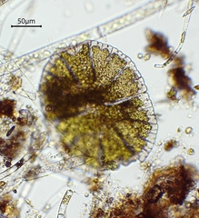 Micrasterias denticulata