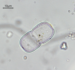 Actinotaenium cucurbita