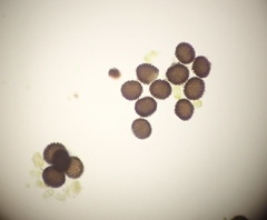 Sphaerocarpos cristatus