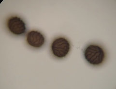 Sphaerocarpos cristatus