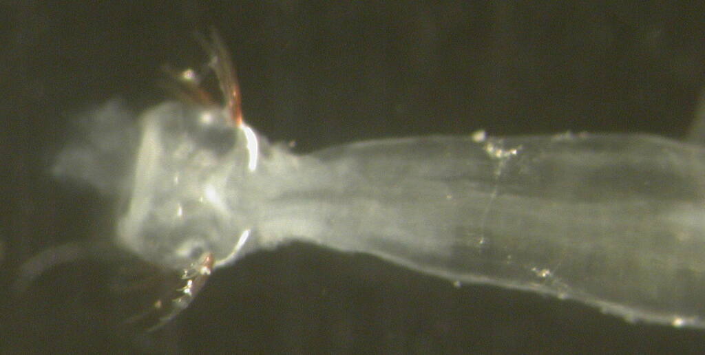 Parasagitta setosa