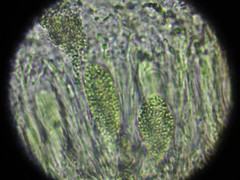 Acarospora clauzadeana