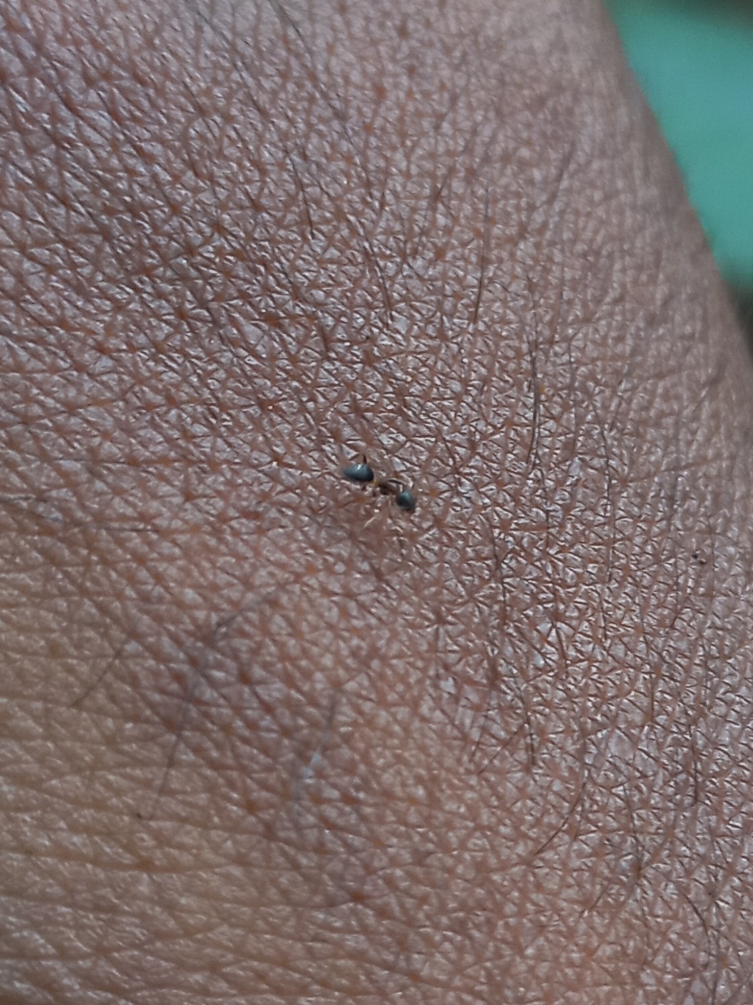 Technomyrmex indicus
