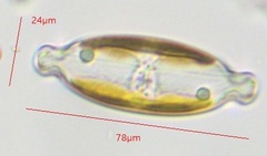 Caloneis amphisbaena