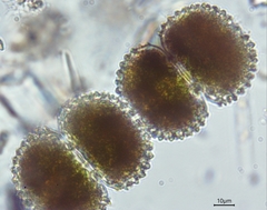 Cosmarium margaritatum