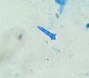 Neonectria lugdunensis - Photo (c) Fay Newbery, some rights reserved (CC BY-NC), uploaded by Fay Newbery