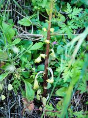 Umbilicus horizontalis