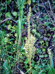 Umbilicus horizontalis