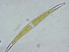 Closterium dianae